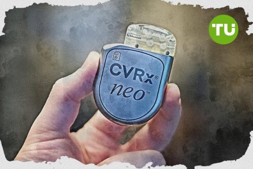 CVRx brings Michael Dale onto board to leverage leadership in medical devices